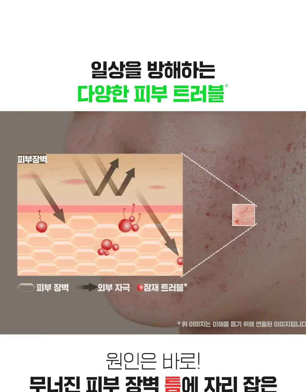 [대용량] 파티온 노스카나인 트러블 크림 75ml 기획(+5ml) 상세페이지 14
